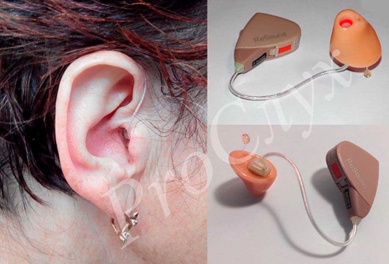 Аксесуари до слухових апаратів