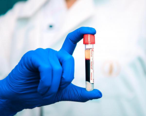 PLASMA THERAPY PLASMA THERAPY