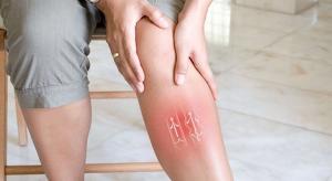 SCLEROTHERAPY