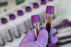 BLOOD SAMPLING