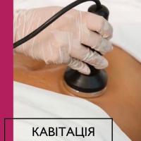 КАВІТАЦІЯ